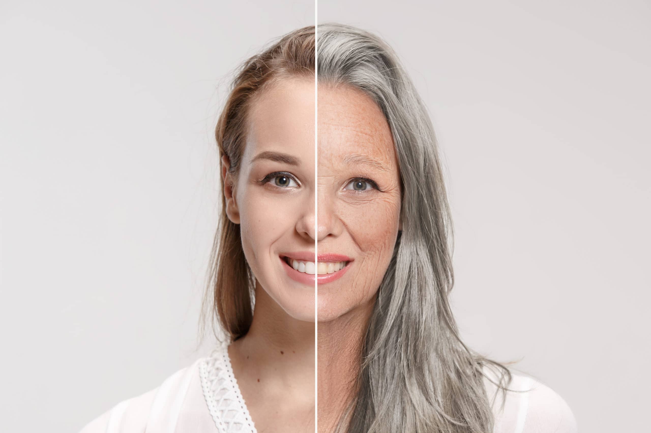 Comparison Portrait of beautiful woman with problem and clean skin, aging and youth concept, beauty treatment